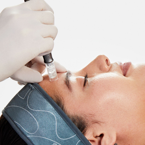 Skin Needling